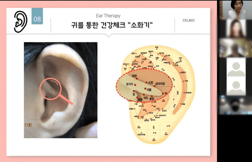 이어 테라피 진행 사진 5
